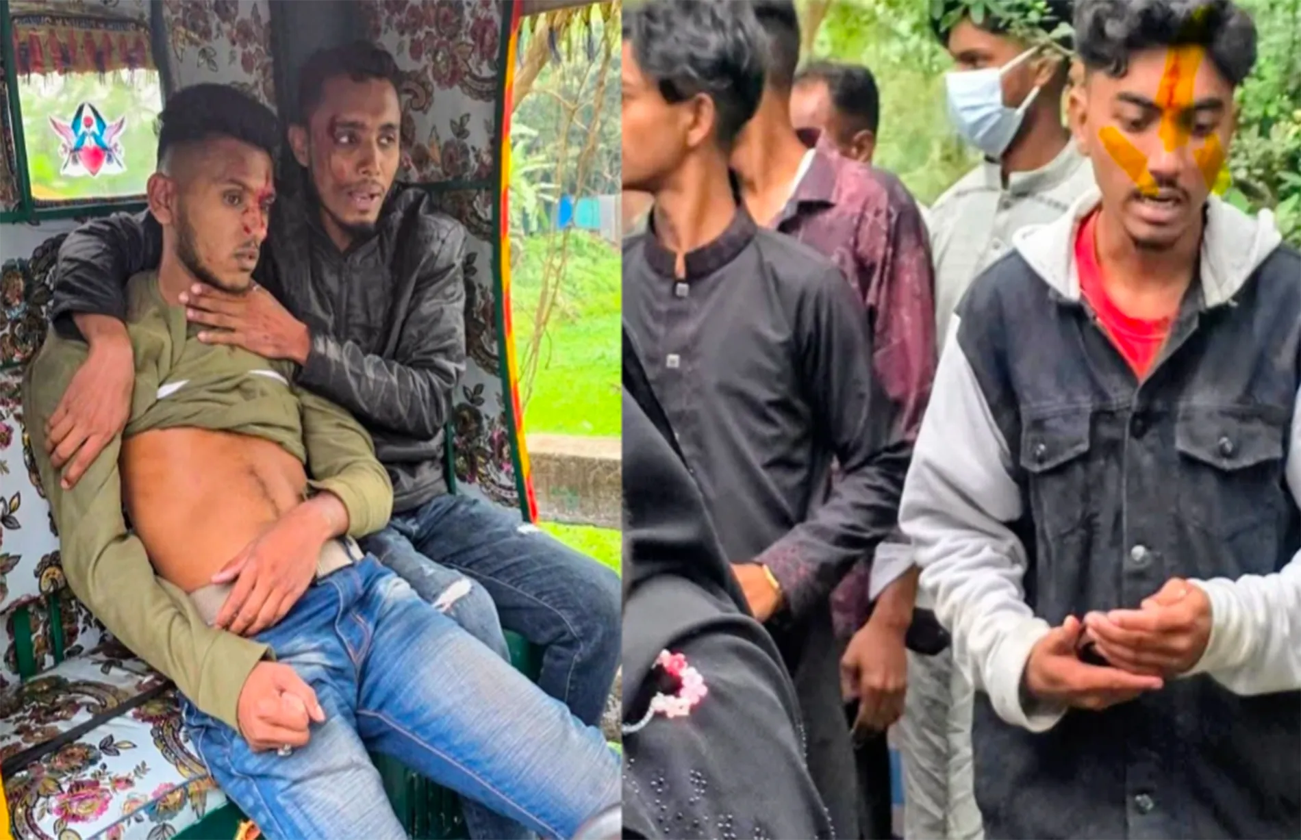 The crash occurred around 2:15 pm when a speeding motorcycle lost control and collided with an easy bike, according to local sources.