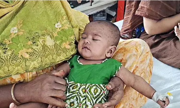Two Infants Die with Measles Symptoms in Gazipur