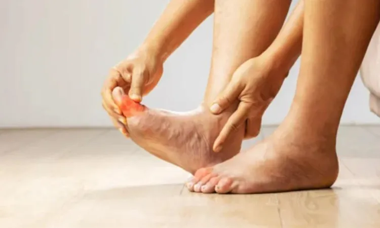 Uric acid problems: 4 foods to limit or avoid