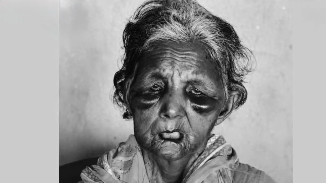 Elderly Speech-Impaired Cleaner Dies After Narsingdi Robbery