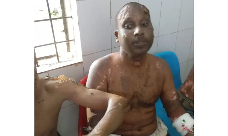 Chattogram Salt Factory Fire Leaves 10 Workers Injured