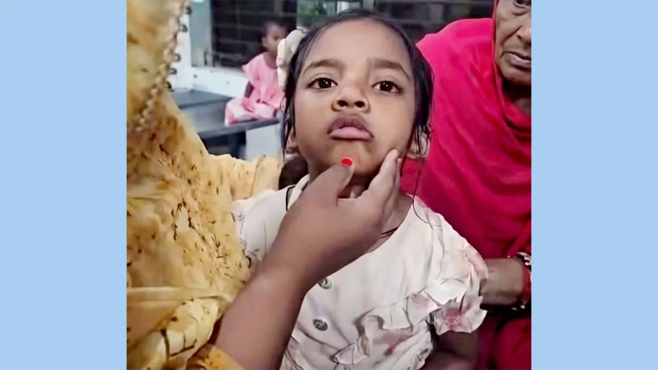 Doctor Explains Child’s “Meowing” After Cat Scratch in Bheramara